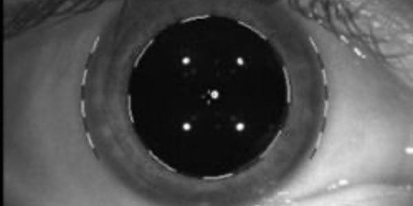 Figure-1