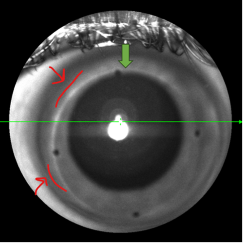 Figure-3.3